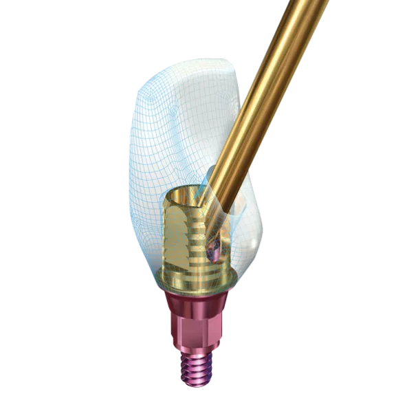SMARTbase